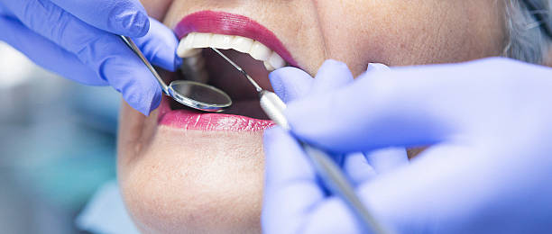 Best Emergency Dentist for Lost Fillings or Crowns in St Clair, PA
